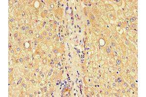 Immunohistochemistry of paraffin-embedded human liver tissue using ABIN7147871 at dilution of 1:100