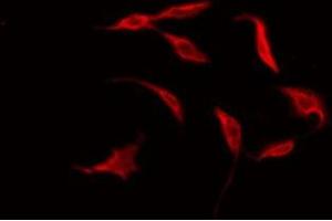 ABIN6275918 staining HuvEc by IF/ICC. (BRS3 antibody  (Internal Region))