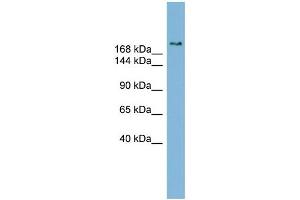 WB Suggested Anti-SETBP1 Antibody Titration:  0. (SETBP1 antibody  (Middle Region))