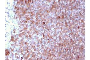 Formalin-fixed, paraffin-embedded human Lymph Node stained with Monospecific Mouse Monoclonal Antibody to LSP1 (LSP1/3025). (LSP1 antibody  (AA 174-278))