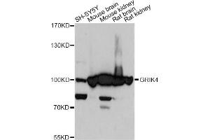 Western blot analysis of extracts of various cell lines, using GRIK4 antibody. (GRIK4 antibody)