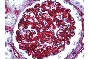 Anti-CD34 antibody IHC of human kidney, glomerulus. (CD34 antibody)