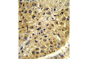 Immunohistochemistry (IHC) image for anti-Dopachrome Tautomerase (DCT) antibody (ABIN3003902) (DCT antibody)