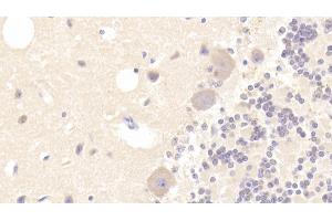 Detection of TUBa3C in Human Cerebellum Tissue using Polyclonal Antibody to Tubulin Alpha 3C (TUBa3C) (TUBA3C antibody  (AA 1-300))