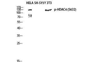 Western Blot (WB) analysis of HeLa, SH-SY5Y, 3T3 lysis using Phospho-HDAC4 (S632) antibody. (HDAC4 antibody  (pSer632))