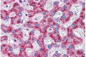 Human Liver: Formalin-Fixed, Paraffin-Embedded (FFPE) (SYPL1 antibody  (N-Term))