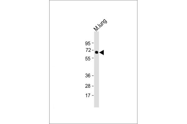 TGFBR2 antibody  (N-Term)