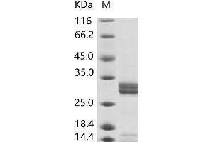 Western Blotting (WB) image for VP4 protein (Fc Tag) (ABIN7198709) (VP4 protein (Fc Tag))