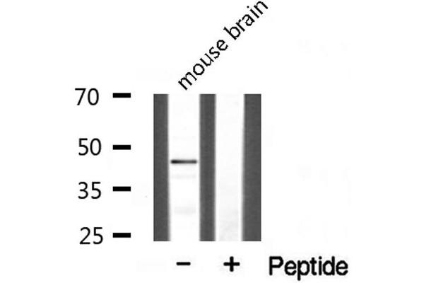 CLN5 antibody  (Internal Region)
