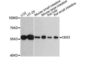 Western blot analysis of extracts of various cell lines, using CES3 antibody. (CES3 antibody)