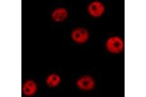 ABIN6279426 staining  HeLa cells by IF/ICC. (KHSRP antibody  (N-Term))