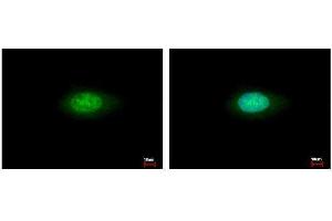 ICC/IF Image Annexin VII antibody detects ANXA7 protein at cytoplasm and nucleus by immunofluorescent analysis.
