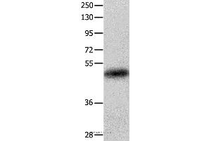 Western blot analysis of Human colon cancer tissue, using KRT23 Polyclonal Antibody at dilution of 1:100