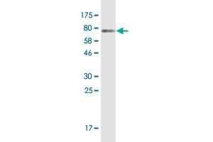 Western Blot detection against Immunogen (76 KDa) . (NAPRT1 antibody  (AA 1-466))