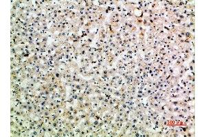 Immunohistochemical analysis of paraffin-embedded human-liver, antibody was diluted at 1:200 (C-Type Lectin Domain Family 4, Member M (CLEC4M) (AA 271-320) antibody)