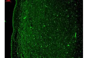 Immunohistochemistry analysis using Mouse Anti-KCNQ4 Monoclonal Antibody, Clone S43-6 . (KCNQ4 antibody  (AA 2-77) (Biotin))