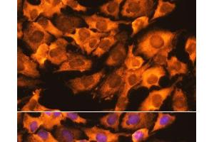 Immunofluorescence analysis of C6 cells using RPS3 Polyclonal Antibody at dilution of 1:100. (RPS3 antibody)