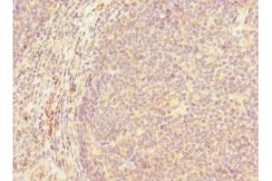 Immunohistochemistry of paraffin-embedded human tonsil tissue using ABIN7154651 at dilution of 1:100 (MCF2L antibody  (AA 850-980))