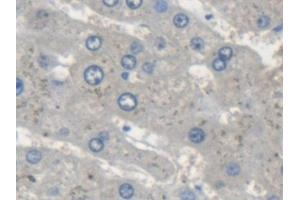 Detection of STAM2 in Human Liver Tissue using Polyclonal Antibody to Signal Transducing Adaptor Molecule 2 (STAM2) (STAM2 antibody  (AA 1-377))