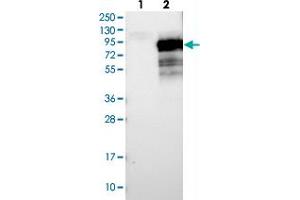 Western blot analysis of Lane 1: Negative control (vector only transfected HEK293T lysate), Lane 2: Over-expression Lysate (Co-expressed with a C-terminal myc-DDK tag (~3. (PALMD antibody)