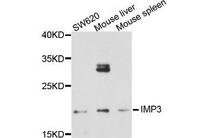 Western blot analysis of extract of various cells, using IMP3 antibody. (IMP3 antibody)
