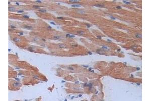 Detection of MYL3 in Mouse Cardiac Muscle Tissue using Polyclonal Antibody to Myosin Light Chain 3, Alkali, Ventricular, Slow Skeletal (MYL3) (MYL3/CMLC1 antibody  (AA 8-199))