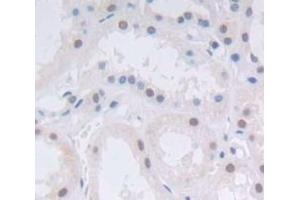 #VALUE! (ASCL1 antibody  (AA 84-236))