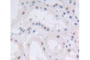 #VALUE! (Achaete Scute Complex Like Protein 1 (AA 84-236) antibody)