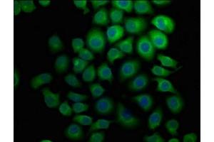 HECW1 antibody  (AA 751-900)