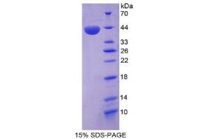 SDS-PAGE (SDS) image for Lipase A, Lysosomal Acid, Cholesterol Esterase (LIPA) (AA 32-358) protein (His tag) (ABIN2125686)