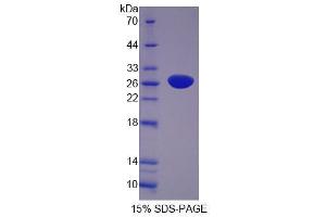Image no. 1 for Period Circadian Protein 1 (AA 208-414) protein (His tag,GST tag) (ABIN6240016)