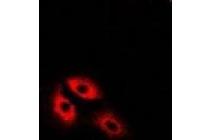 Immunofluorescent analysis of MDH2 staining in U2OS cells. (MDH2 antibody)