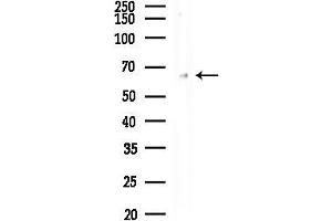 Western blot analysis of lysates from COLO205 cells(heat-shock treatment), using Phospho-Estrogen Receptor alpha (Ser104) Antibody at 1/1000 dilution.