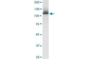 HIP1R MaxPab polyclonal antibody.