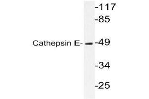 Western blot (WB) analysis of Cathepsin E antibody in extracts from HUVECcells. (Cathepsin E antibody)