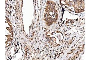 IHC analysis of Angiogenin/ANG using anti-Angiogenin/ANG antibody (ABIN4886457).
