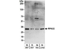 Western Blotting (WB) image for anti-Replication Protein A2, 32kDa (RPA2) (AA 220-270) antibody (ABIN7454567)