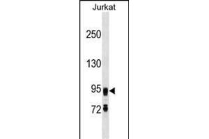 FIG4 Antibody (C-term) (ABIN1537627 and ABIN2849648) western blot analysis in Jurkat cell line lysates (35 μg/lane). (FIG4 antibody  (C-Term))