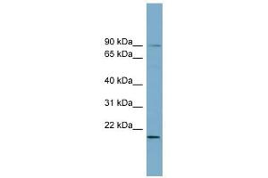 KIAA0776 antibody used at 1 ug/ml to detect target protein.