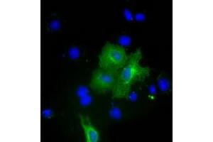 Anti-PKLR mouse monoclonal antibody (ABIN2453474) immunofluorescent staining of COS7 cells transiently transfected by pCMV6-ENTRY PKLR (RC206455). (PKLR antibody)