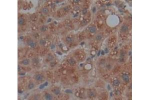 IHC-P analysis of Human Tissue, with DAB staining. (SMPD1 antibody  (AA 319-579))