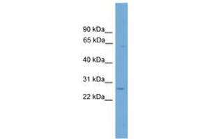 Image no. 1 for anti-Tubulointerstitial Nephritis Antigen-Like 1 (TINAGL1) (AA 359-408) antibody (ABIN6745183) (TINAGL1 antibody  (AA 359-408))