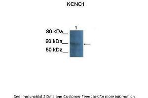 Lanes:   100 ug CHO cell lysate  Primary Antibody Dilution:   1:1000  Secondary Antibody:   Goat anti-rabbit HRP  Secondary Antibody Dilution:   1:25000  Gene Name:   KCNQ1  Submitted by:   Anonymous (KCNQ1 antibody  (N-Term))