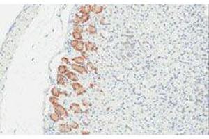 Immunohistochemistry (IHC) image for anti-TLR4 /MD2 Complex antibody (ABIN2665420) (TLR4 /MD2 Complex antibody)