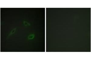 Immunofluorescence analysis of HeLa cells, using CD4 (Ab-433) Antibody. (CD4 antibody  (AA 401-450))