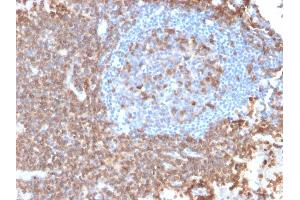 Formalin-fixed, paraffin-embedded human Lymph Node stained with CD43 Mouse Recombinant Monoclonal Antibody (rSPN/839). (Recombinant CD43 antibody)