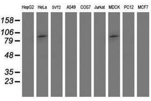 Image no. 2 for anti-Proteasome (Prosome, Macropain) 26S Subunit, Non-ATPase, 2 (PSMD2) antibody (ABIN1500482)