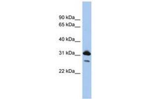 Image no. 1 for anti-RAP1B, Member of RAS Oncogene Family (RAP1B) (N-Term) antibody (ABIN6744003) (RAP1B antibody  (N-Term))
