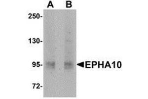Western blot analysis of EphA10 in 293 cell lysate with AP30318PU-N EphA10 antibody at (A) 1 μg/ml and (B) 2 μg/ml.