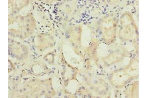 Immunohistochemistry of paraffin-embedded human kidney tissue using ABIN7175029 at dilution of 1:100 (C5ORF22 antibody  (AA 101-420))